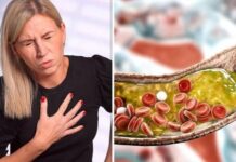 Ayurvedic Home Remedies to Reduce Cholesterol Level Ayurvedic Remedies to Reduce Cholesterol Level